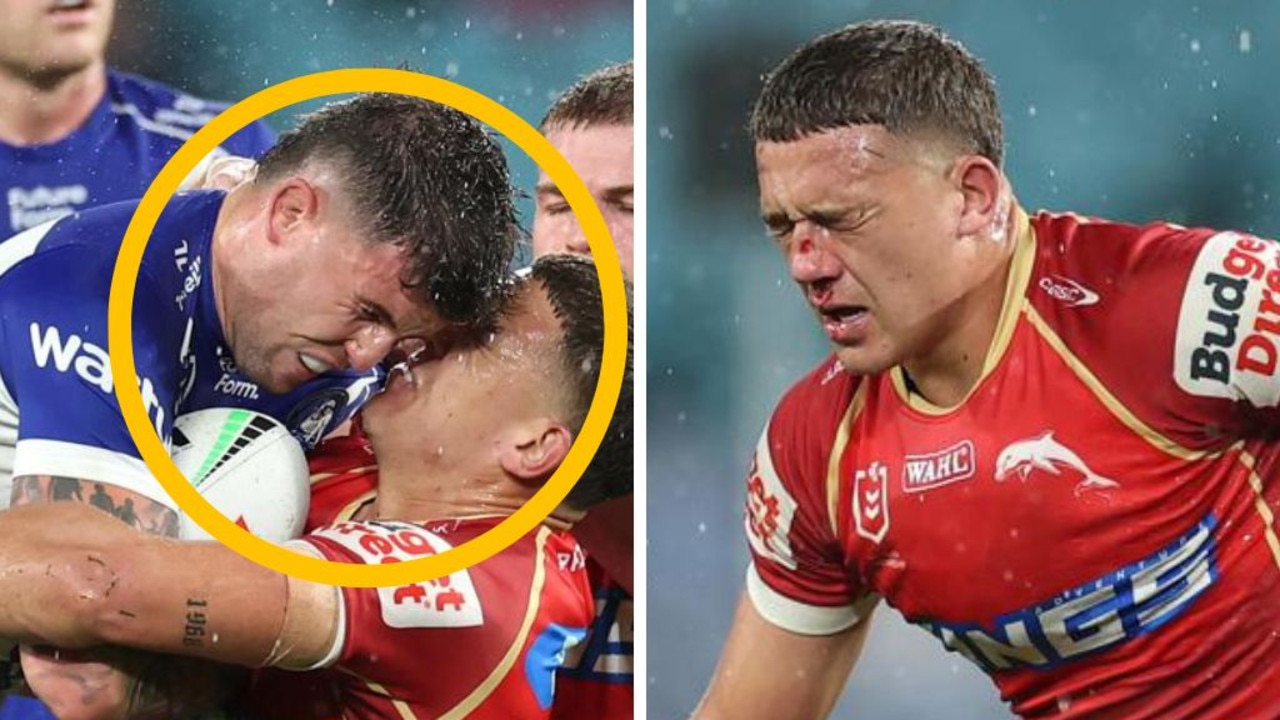 Dolphin’s nose ‘shattered’ in horror clash