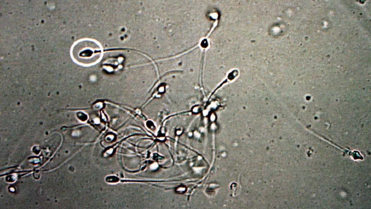 Dr Shanna Swan says that the sperm count of Western men has plunged by over 50 per cent in less than 40 years.