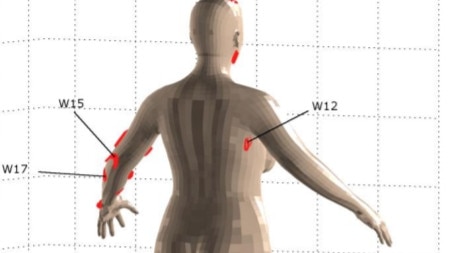 Images depicting the wounds to Shandee Blackburn.