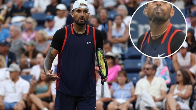 Nick Kyrgios spitting at the US Open