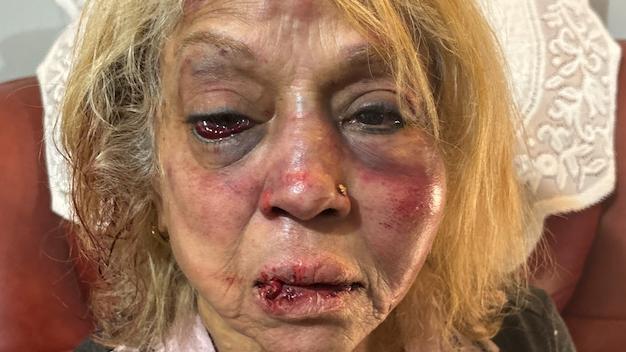 Ninette Simons, the victim of an assault and burglary in the Perth suburb of Girrawheen. Picture: WA Police