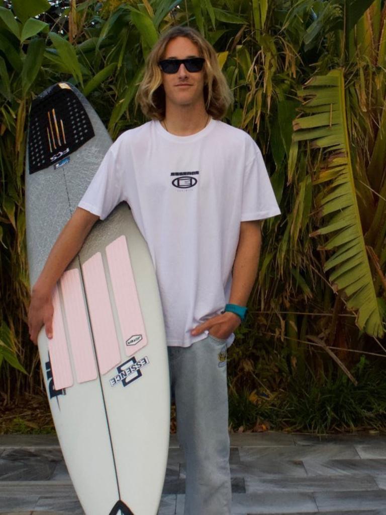 Despite warnings that his skin will take years to fully recover, Kirby is determined to return to surfing.