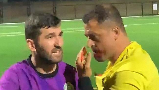 The soccer referee said he has ‘nothing against’ his alleged attacker. Picture: Supplied