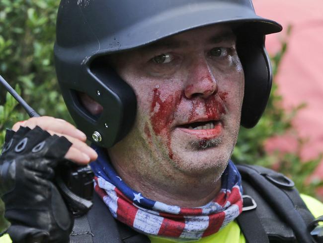 A white nationalist demonstrator, bloodied after a clash with a counter demonstrator, talks on the radio receiver at the entrance to Lee Park in Charlottesville. Picture: AP Photo/Steve Helber