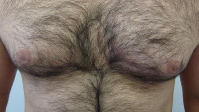 Before surgery.