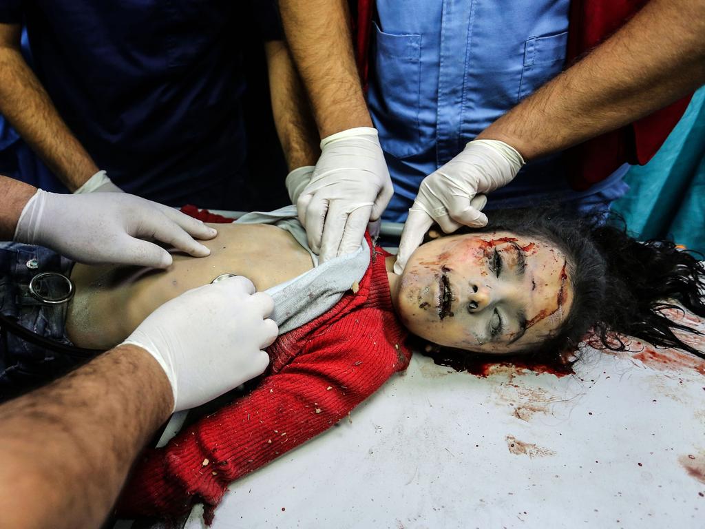 A Palestinian child receives treatment after Israeli air raids at Nasser Medical Hospital in Khan Yunis, Gaza. After four week of fighting, more than 40% of the dead in Gaza are children. Picture: Ahmad Hasaballah/Getty Images