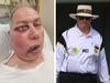 Umpire’s gruesome injury after ‘brutal blow’
