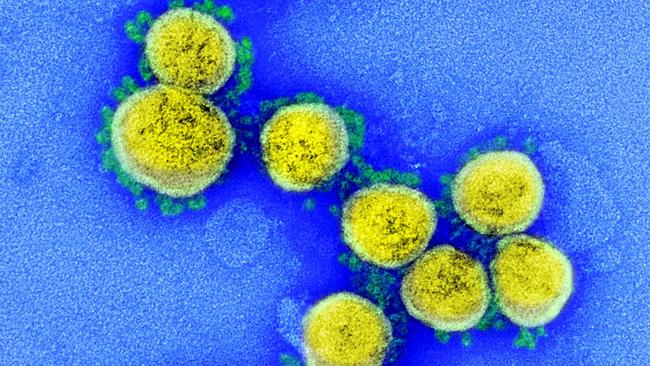 This undated handout image obtained August 11, 2020, courtesy of the National Institute of Allergy and Infectious Diseases(NIH/NIAID), shows a ransmission electron micrograph of SARS-CoV-2 virus particles, isolated from a patient, captured and color-enhanced at the NIAID Integrated Research Facility (IRF) in Fort Detrick, Maryland. - Although none of the coronavirus vaccines under development has proved its efficacy yet in clinical trials, at least 5.7 billion doses have been pre-ordered around the world. First shipments of a COVID-19 vaccine created by Western laboratories have often been snapped up by the United States.Five vaccines -- three Western and two Chinese -- are in Phase 3 efficacy trials involving thousands of people.In a surprise announcement, Russian President Vladimir Putin claimed on August 11, 2020 that a vaccine dubbed "Sputnik V" -- after the Soviet satellite -- conferred "sustainable immunity" against the novel coronavirus. (Photo by Handout / National Institute of Allergy and Infectious Diseases / AFP) / RESTRICTED TO EDITORIAL USE - MANDATORY CREDIT "AFP PHOTO /NATIONAL INSTITUTE OF ALLERGY AND INFECTIOUS DISEASES/HANDOUT " - NO MARKETING - NO ADVERTISING CAMPAIGNS - DISTRIBUTED AS A SERVICE TO CLIENTS