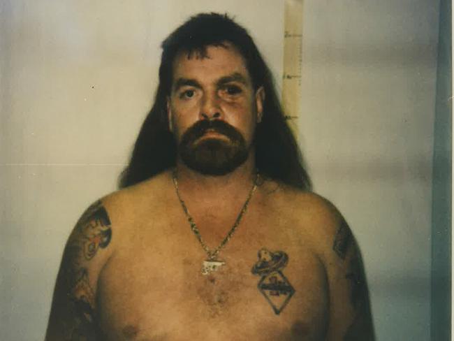 Sid Collins, showing scars he received after being shot by Mark ‘Chopper’ Read.