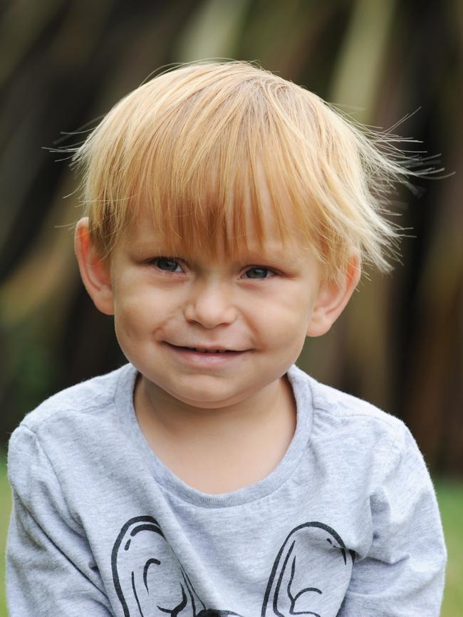 George McNees was diagnose with an aggressive Brain Cancer at 11-months-old. Picture: Fiona Harding