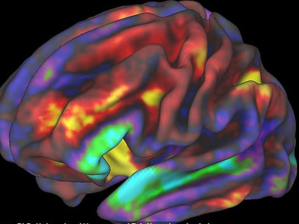 An image of a brain while a child performs a working memory task. The regions in yellow and red are most active. Picture: ABCD