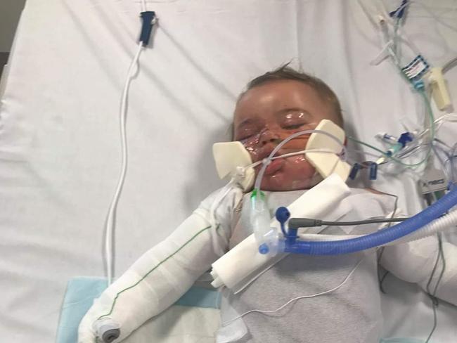 Braylen Macnamara spent 16 days in the paediatric intensive care unit.