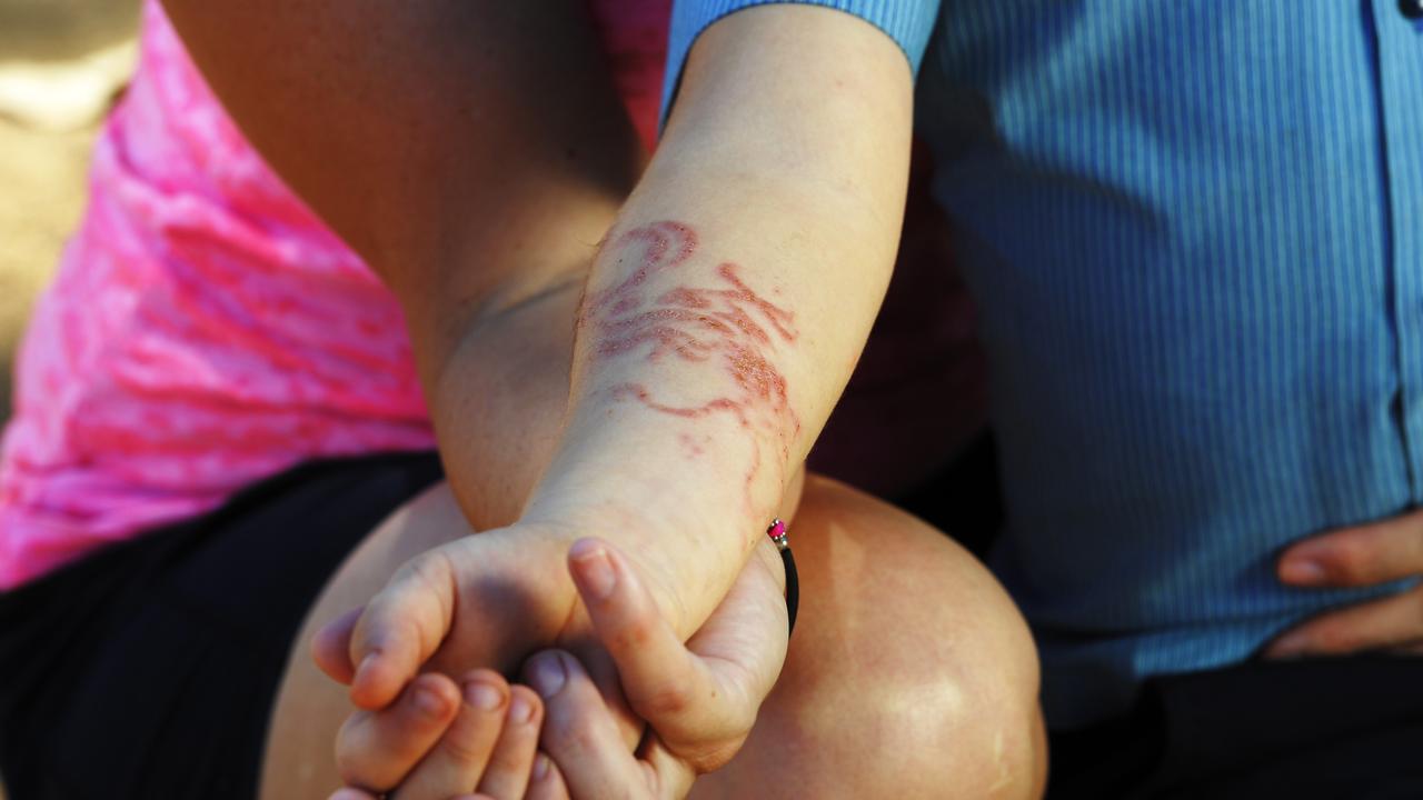 A mum has warned a Facebook group against Bali henna tattoos, in another case of skin reactions after her child received the temporary design.