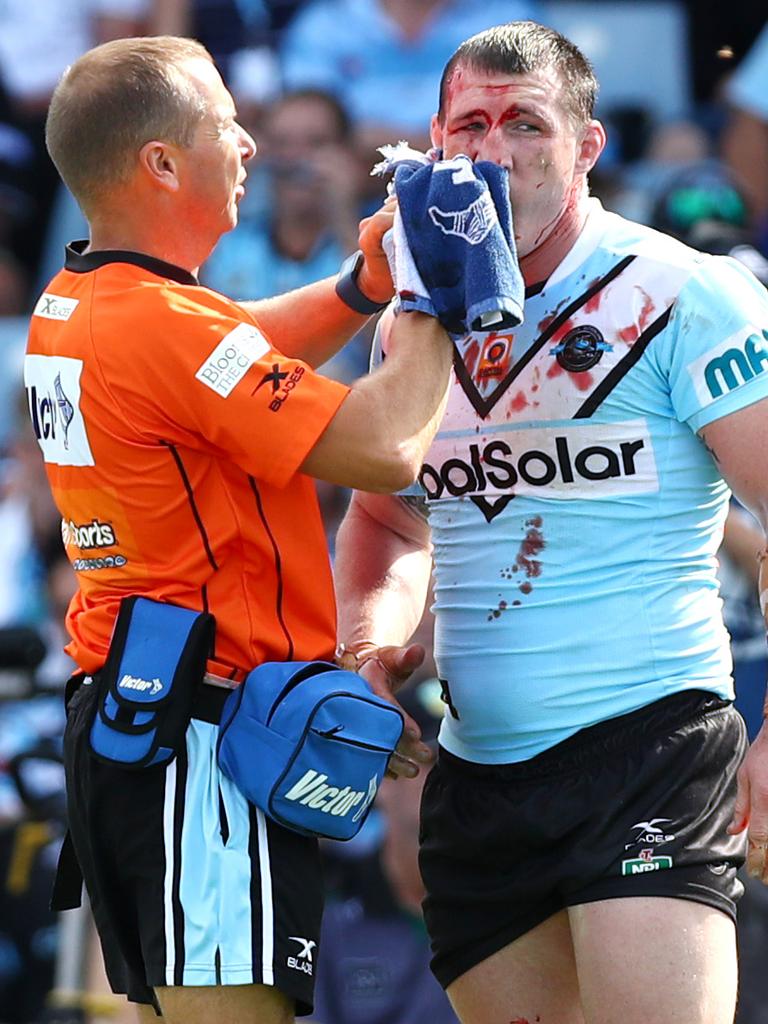 Gallen gets patched up after a brutal hit. Picture: Gregg Porteous