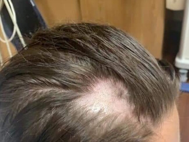 Ms Timm's daughter was forced to shave her head after trying the Pantene conditioner. Picture: GoFundMe