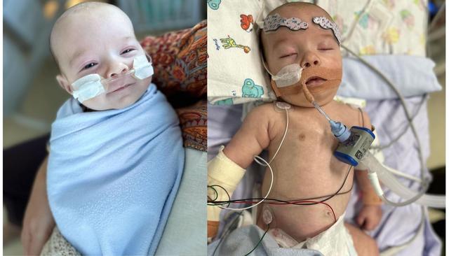 A Logan mother has revealed the scrambling and desperate minutes that followed her newborn turning blue, and his ongoing battle with multiple surgeries for his “different anatomy”. 