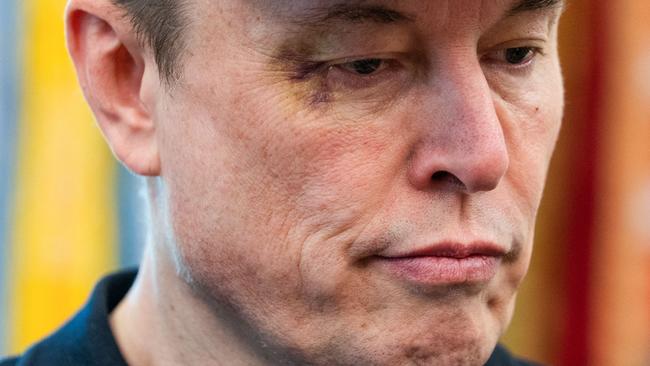 Americans without health insurance probably aren’t encouraging their kids to punch them in the face – Mr Musk’s explanation for his black eye here. Picture: Allison Robbert/AFP