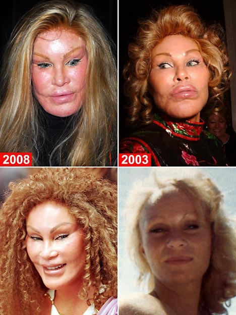 Many faces of the Catwoman, Jocelyn Wildenstein.