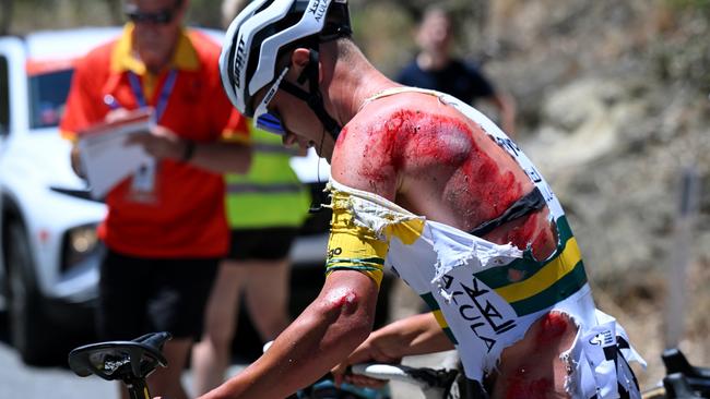 Luke Plapp of Australia and Team Jayco AlUla injury after being involved in a crash during the 24th Santos Tour Down Under (Photo by Tim de Waele/Getty Images)