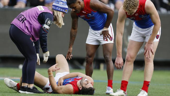 Teammates and medical staff attend to the fallen star. Photo: Michael Klein