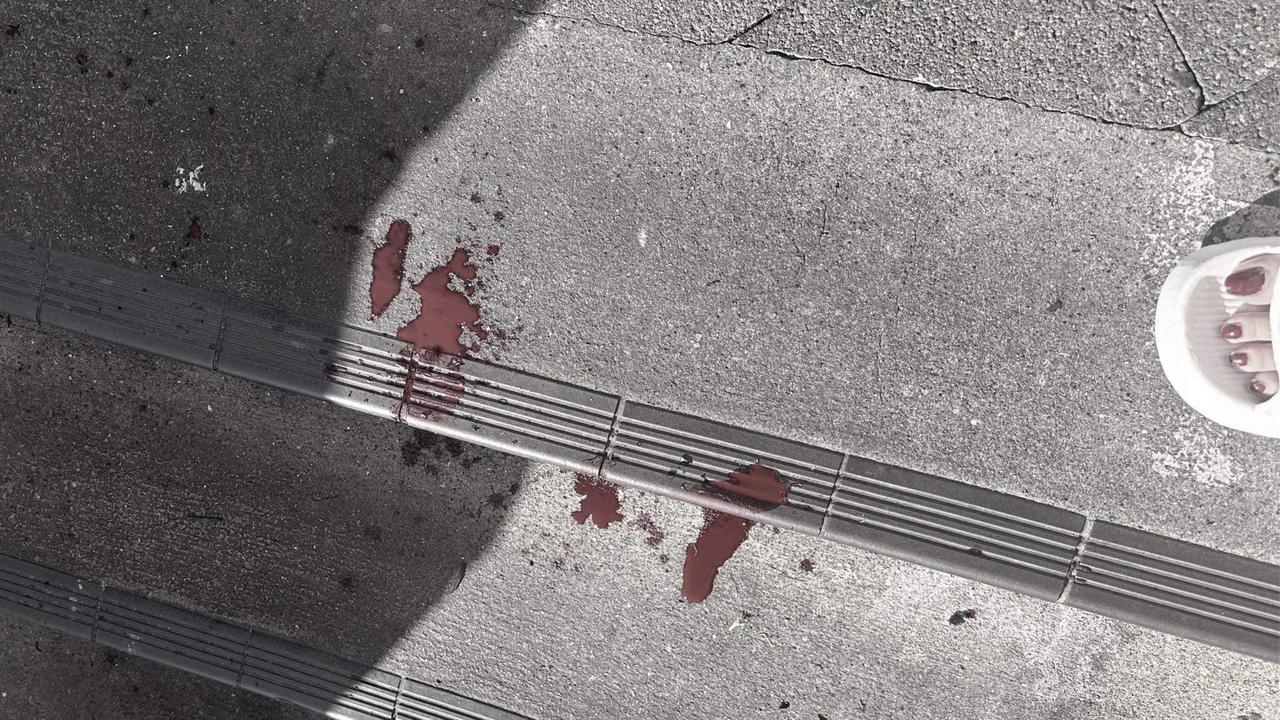 Blood seen on the pavement. Picture: Facebook