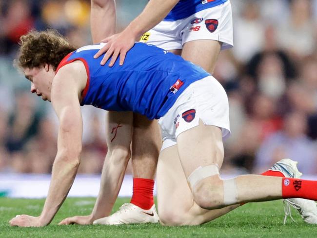 Ben Brown was left bloodied by the Rayner tackle. Picture: AFL Photos/Getty Images