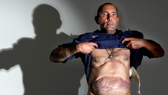 Hylton Miller was shot while walking with his family in Surfers Paradise in 2010. He left South Africa because of its violence. No-one was ever convicted for the shooting.