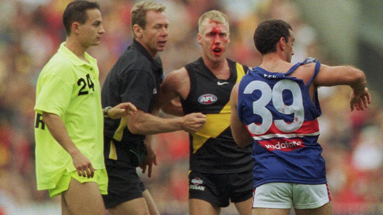 Matthew Knights and Tony Liberatore after the incident.