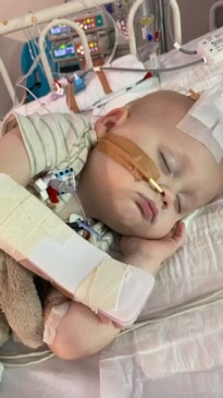 Baby fighting rare form of brain cancer