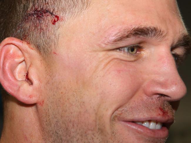 Selwood all smiles after a win and a few stitches. Picture: Getty Images