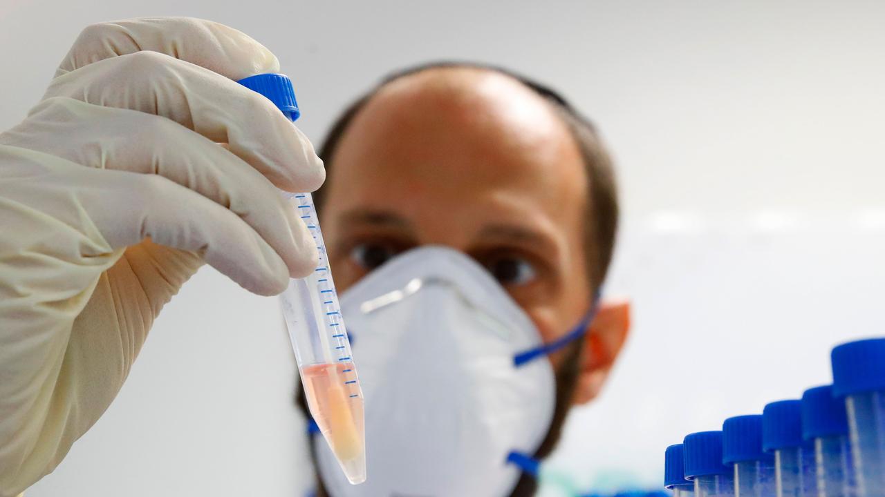 A lab technician holds a tube containing a swab sample taken for COVID-19 serological test. (Photo by JACK GUEZ / AFP)