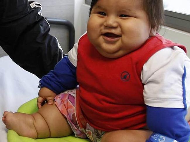 Colombia’s fattest baby Santiago Mendoza ‘rescued’ from family by ...