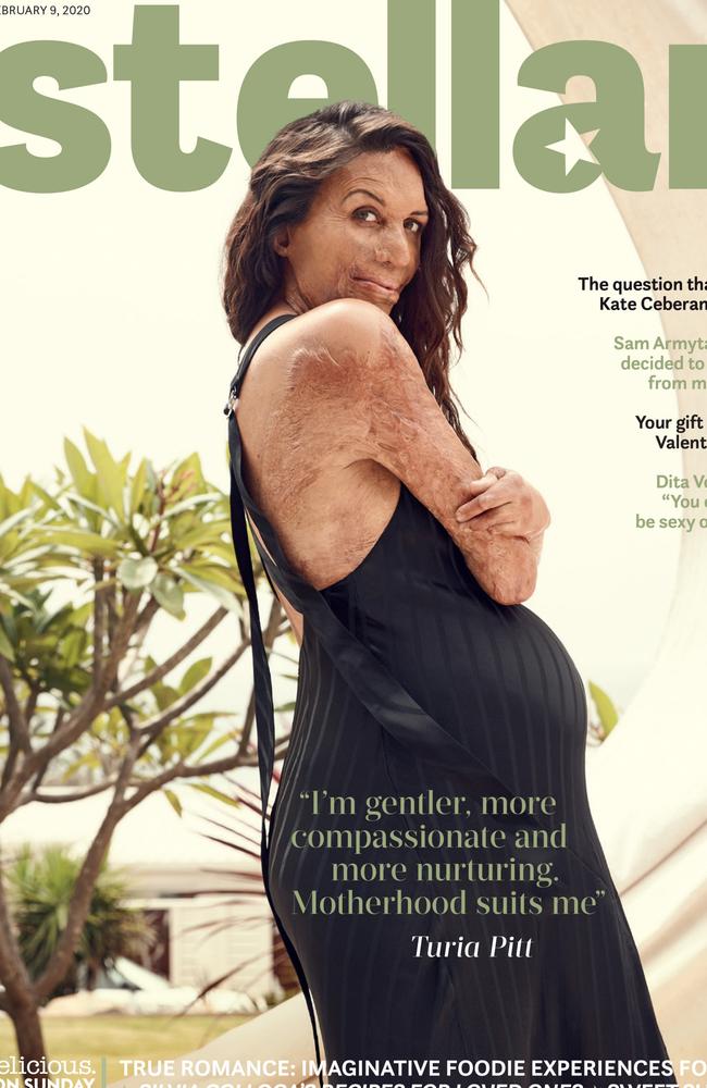 Turia Pitt is this week’s Stellar cover star.