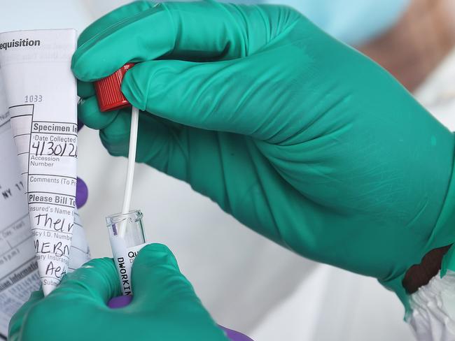 WANTAGH, NEW YORK - APRIL 30: A Health Care Worker seals a coronavirus swab after testing at the Pro Health Urgent Care coronavirus testing site on April 30, 2020 in Wantagh, New York. The World Health Organization declared coronavirus (COVID-19) a global pandemic on March 11th.   Al Bello/Getty Images/AFP == FOR NEWSPAPERS, INTERNET, TELCOS & TELEVISION USE ONLY ==