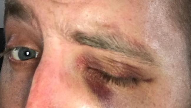 The young officer who was kicked in the head at Highpoint shopping centre in Maribyrnong.