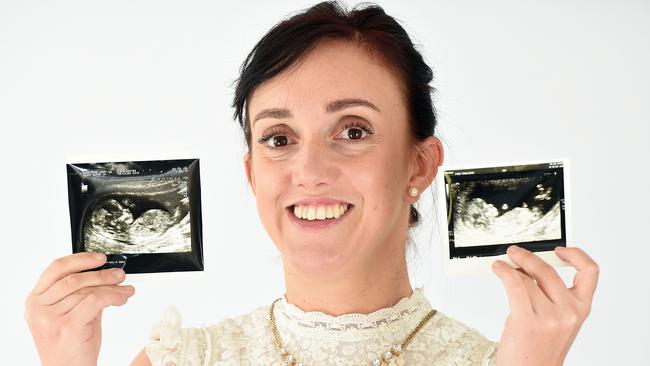 ONLINE ONLY - ONLINE ONLY - PIC BY WAYNE PEERRY / CATERS NEWS - (PICTURED:Faye Wilkins at their home in Plymouth,Devon. faye has Uterus didelphys.) -A mum born with two vaginas, two cervixes, and two wombs now has two healthy children after falling pregnant naturally in both. Faye Wilkins, 31, from Plymouth, was diagnosed with a rare condition called uterus didelphys - causing her to have two sets of female reproductive organs. At the age of 14 Fayes uterus ruptured and an examination revealed the unusual condition - two months later she had corrective surgery to turn her two vaginas into one but her two cervixes and wombs remain. Doctors warned Faye that her chances of falling pregnant and carrying a baby to full term was minimal but miraculously, after six miscarriages, she went on to have two children in both wombs. Faye is now sharing her story to raise awareness about the condition. SEE CATERS COPY.