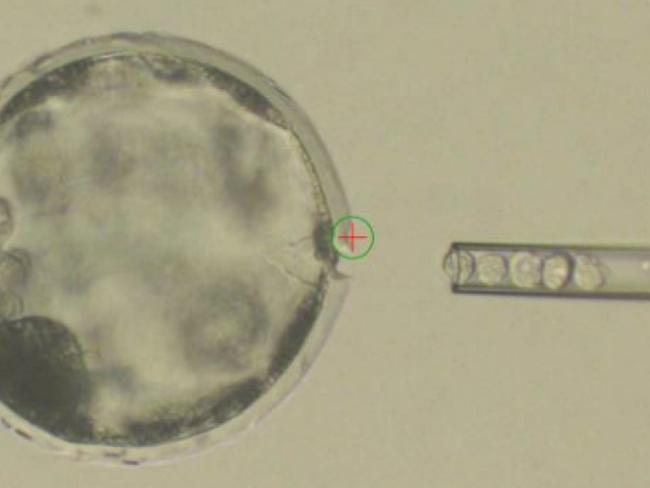 This photo provided by the Salk Institute shows the injection of human stem cells into a pig blastocyst. The experiment was a very early step toward the possibility of growing human organs inside animals for transplantation. Picture: Salk Institute via AP