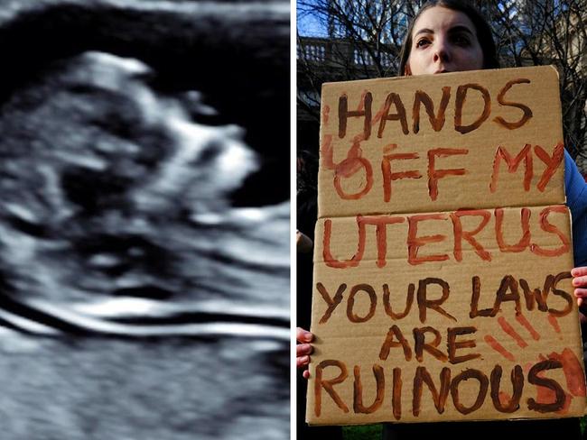 Warning over ‘dangerous’ abortion debate