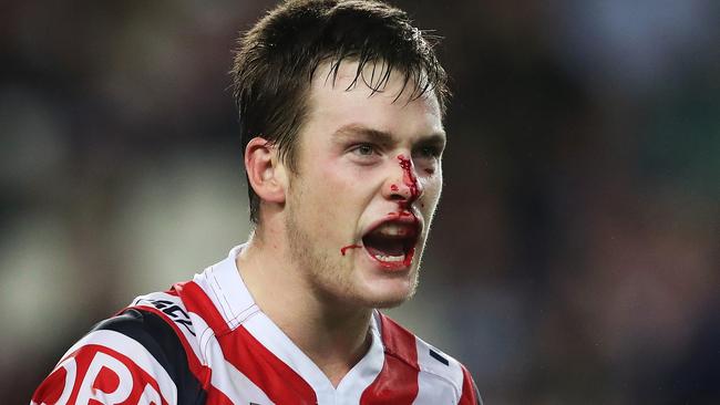 Luke Keary plays on with blood on his nose.