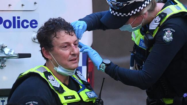 A police officer receives treatment.