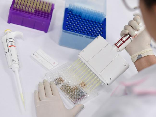 A researcher works on the diagnosis of suspected coronavirus COVID-19 cases in Belo Horizonte, Brazil. Picture: AFP