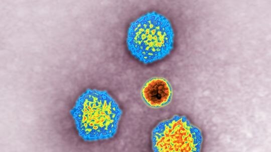 Adenovirus was detected in many of the British pediatric hepatitis cases.