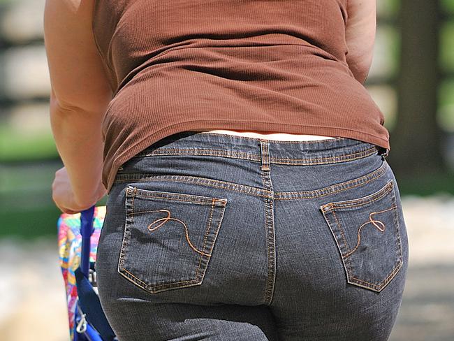 Private ... Only 10 per cent of obesity surgery takes place in public hospitals. Picture: Supplied