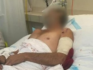 A man is hospitalised after a dog attack. Picture: 7News