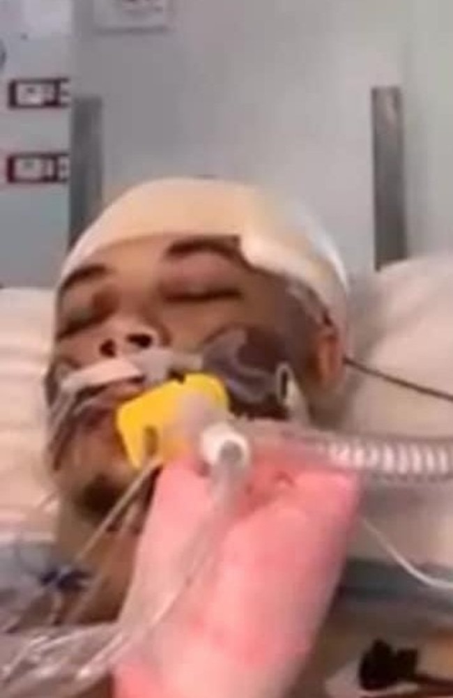 Christian Mackay in a coma in ICU where he remained for weeks after the attack from his neighbour.