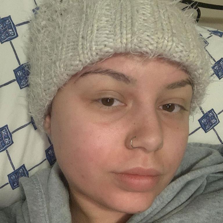 Cancer Symptoms Womans Cold Eczema Rash Was Actually Cancerous