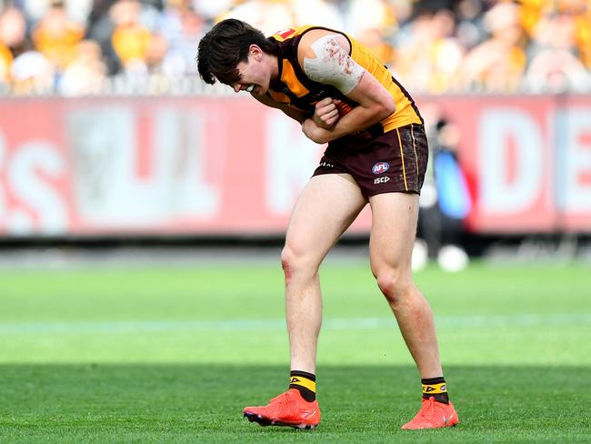 MELBOURNE, AUSTRALIA – AUGUST 18: Will Day of the Hawks receives medical attention during the round 23 AFL match between Hawthorn Hawks and Richmond Tigers at Melbourne Cricket Ground, on August 18, 2024, in Melbourne, Australia. (Photo by Josh Chadwick/AFL Photos/via Getty Images)