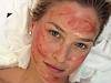 Supermodel reveals bloody beauty secret