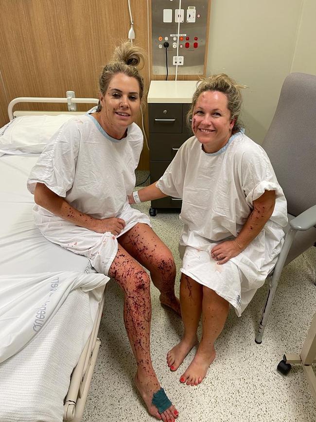 Elmarie Steenberg and Marle Swart recovering in hospital.