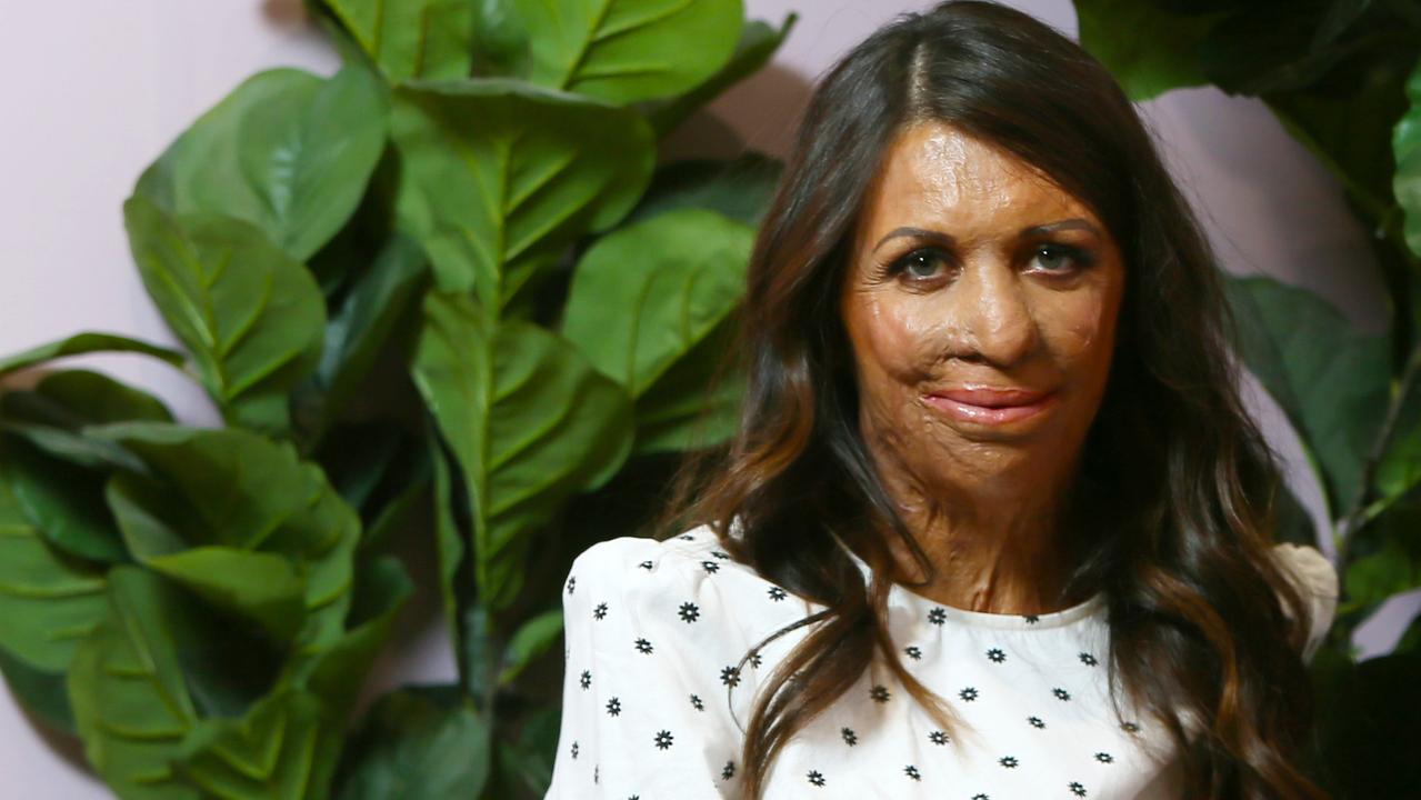 Turia Pitt To Tackle New Zealands Coast To Coast 2019 In Next Marathon